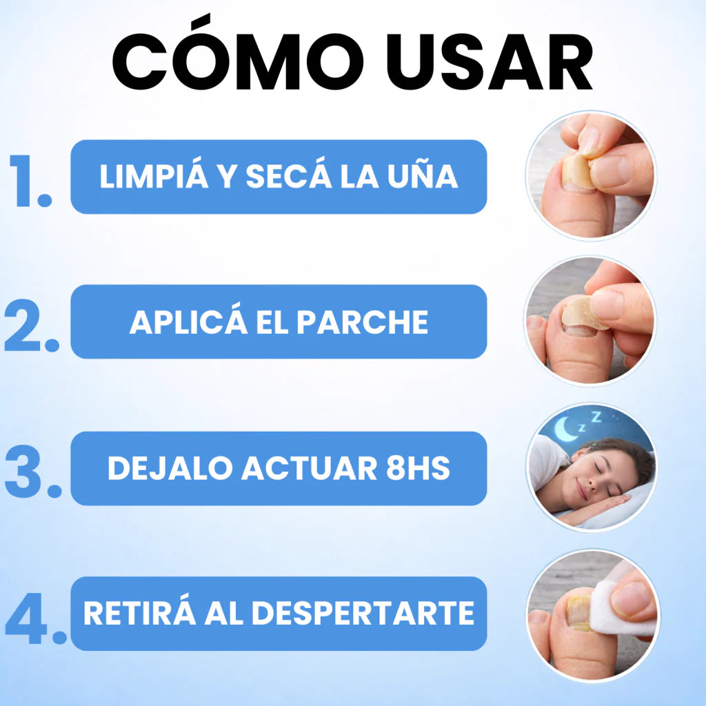 Onyclair® Parches Antihongos - Eliminan Hongos y Regeneran tus Uñas