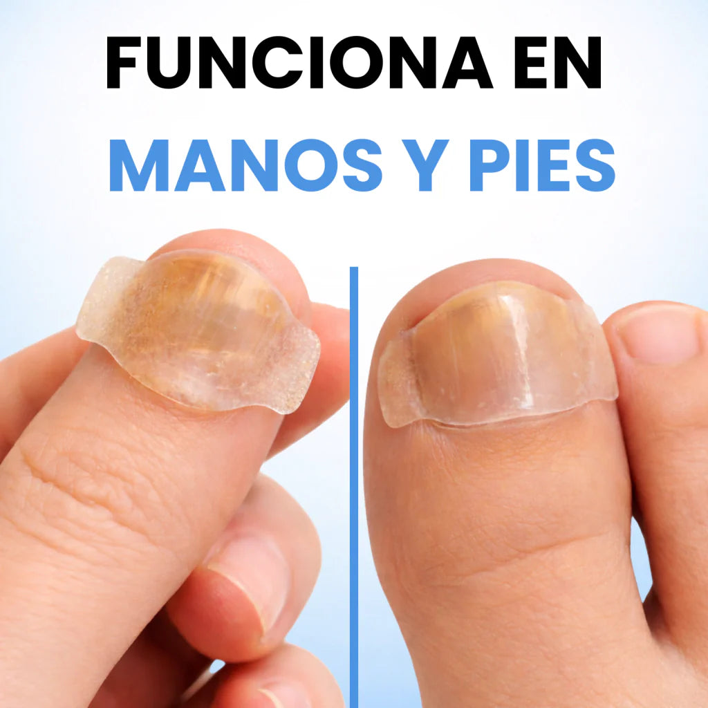 Onyclair® Parches Antihongos - Eliminan Hongos y Regeneran tus Uñas