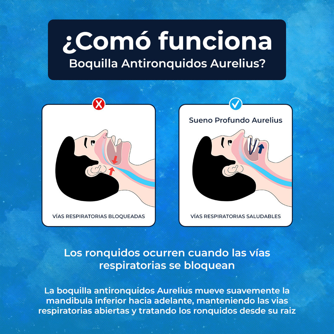Boquilla Antironquidos Aurelius™