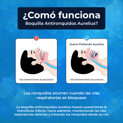 Boquilla Antironquidos Aurelius™